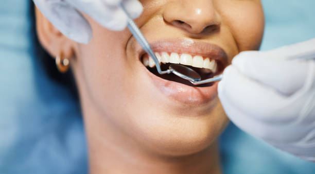 Best Emergency Dentist No Insurance  in Mccom, MS