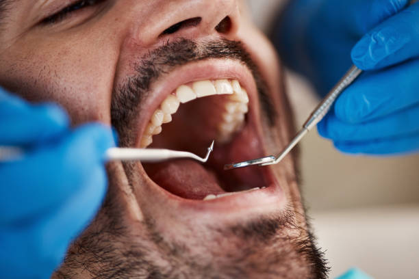 Best Dentist for Severe Toothache  in Mccom, MS