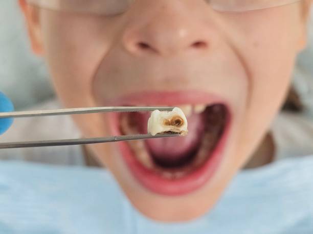  Mccom, MS Emergency Dentist Pros